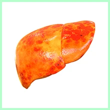 Cirrhosis of the liver Cirrhosis of the Liver