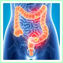 Enterocolitis Enterocolitis