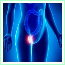 Hemorrhoids Hemorrhoids