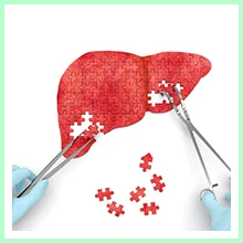 Hepatitis Hepatitis