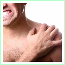 Neuritis Neuritis
