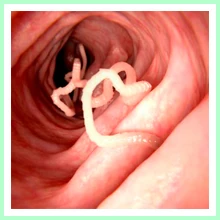 Parasitic Infections Parasitic Infections