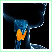 Thyroid dysfunction - Hypothyroidism Thyroid dysfunction - Hypothyroidism