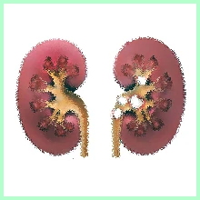 Urolithiasis disease urolithiasis disease3